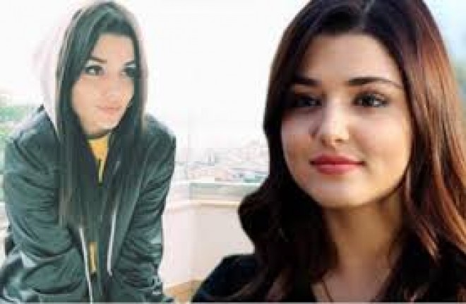 Aktrisa dodağına dolğu vurdurdu