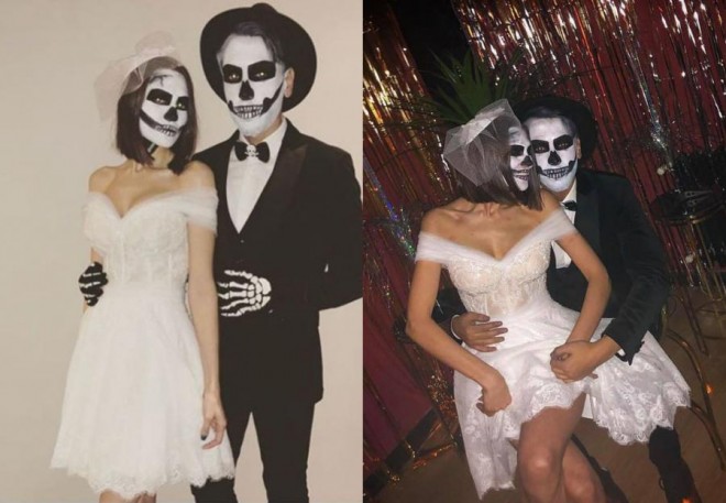 Günay Musayeva özünü eybəcər hala saldı - foto