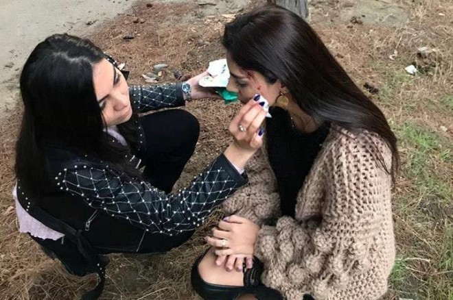 Aktrisanın başı qanadı - foto