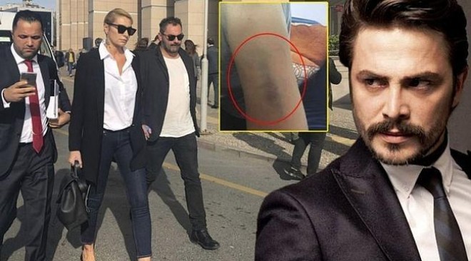 Müğənni ilə aktyor məhkəmədə çəkişir