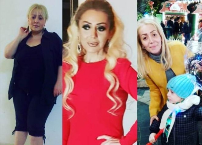 Emma Ələkbərzadə indi və keçmişdə - foto