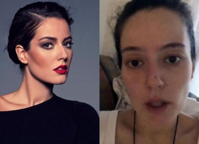 Aktrisa&nbsp;"Donuz qripi"nə yoluxdu