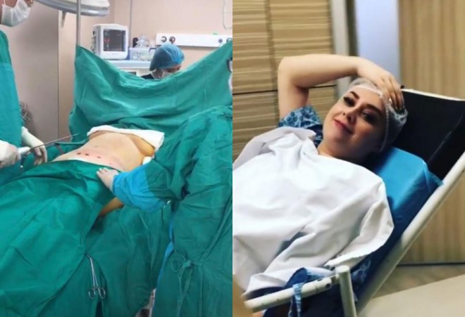 Xatirə İslam əməliyyat olundu - video&nbsp;