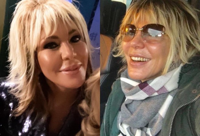 Brilliant Dadaşova üzünə nə etdirib? - foto