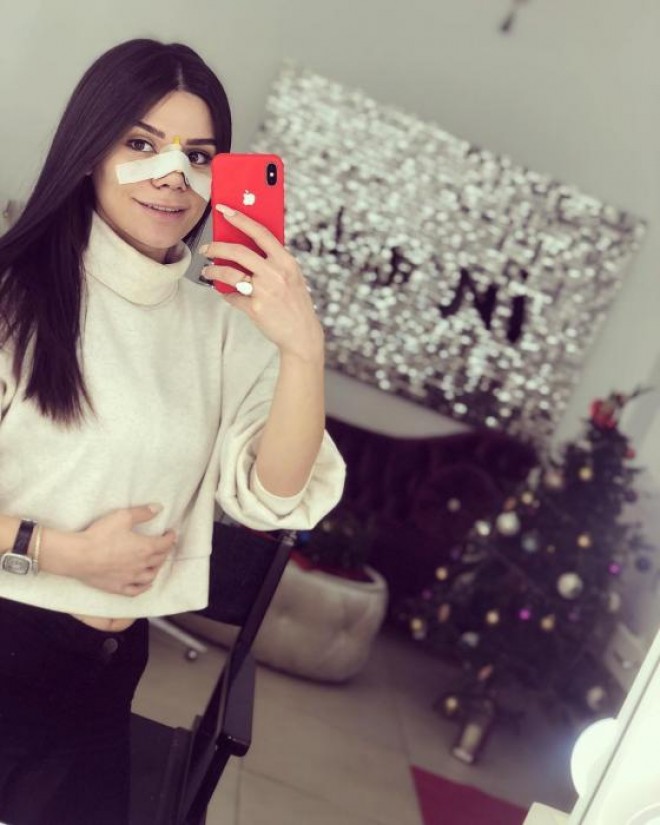 Aysun plastik əməliyyat olundu