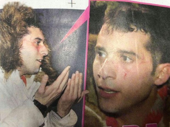 Aktyoru sevgilisi döydü - foto