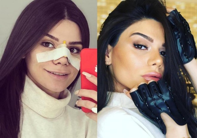 Aysun dodağını böyütdürdü - foto