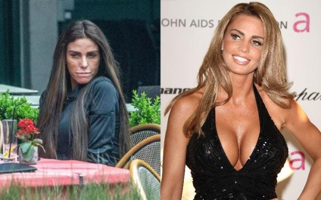 Model və müğənni üzünü dartdırdı&nbsp;