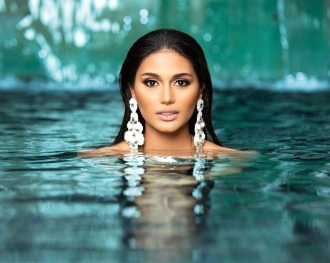 Venesuela gözəlinin sirri açıldı - foto