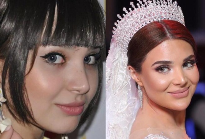 Ülviyyə şayiələrə münasibət bildirdi&nbsp;