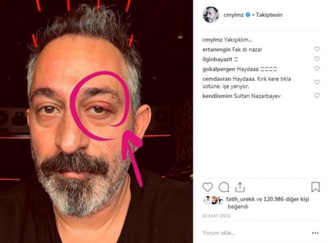 Cem Yılmaz gözü ilə təəccübləndirdi&nbsp;