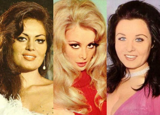 "Yeşilçam"ın aktrisası əməliyyat olundu