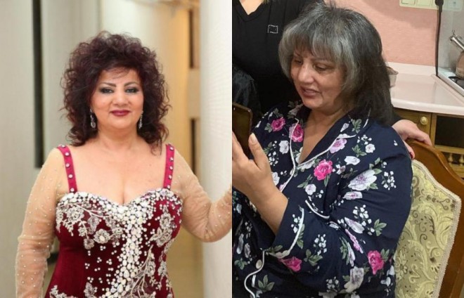 Zöhrə Abdullayeva tanınmaz halda - foto