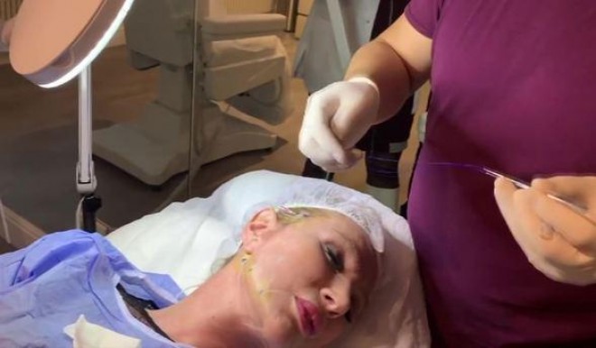 Seda Sayan üzünü dartdırdı - foto