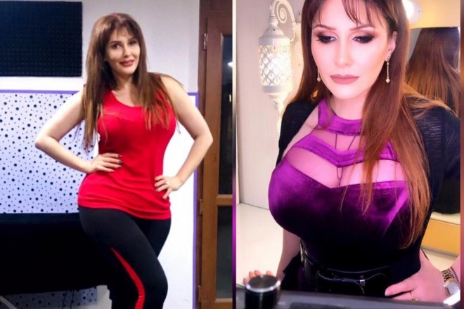 Çimnaz sinəsini hədsiz böyütdürdü - foto