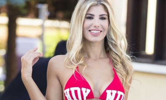 Müğənninin üzü yandı - foto