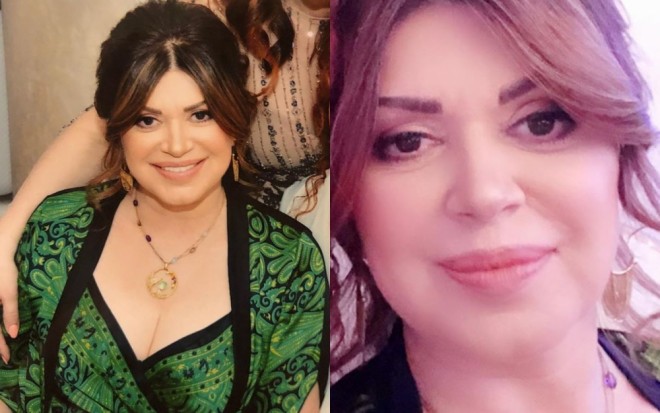 Sənubər İsgəndərli daha eynək taxmır - foto