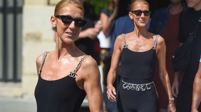 Müğənni bir dəri, bir sümük qaldı - foto