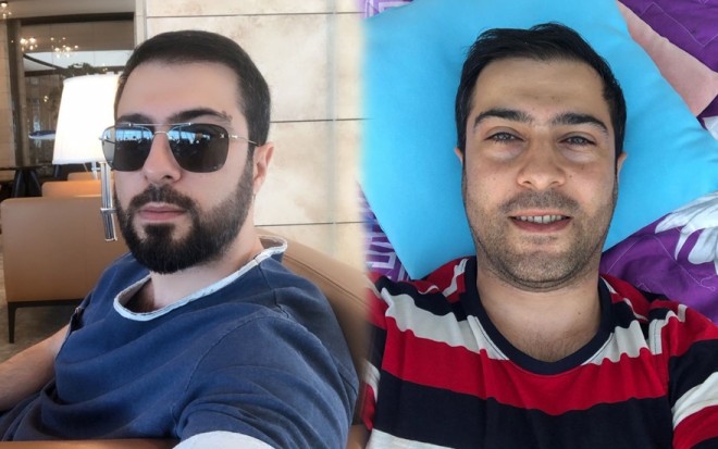 Meyxanaçı imicini dəyişdi - foto