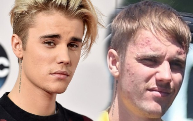 Castin Biberin&nbsp;üzü səpdi - foto