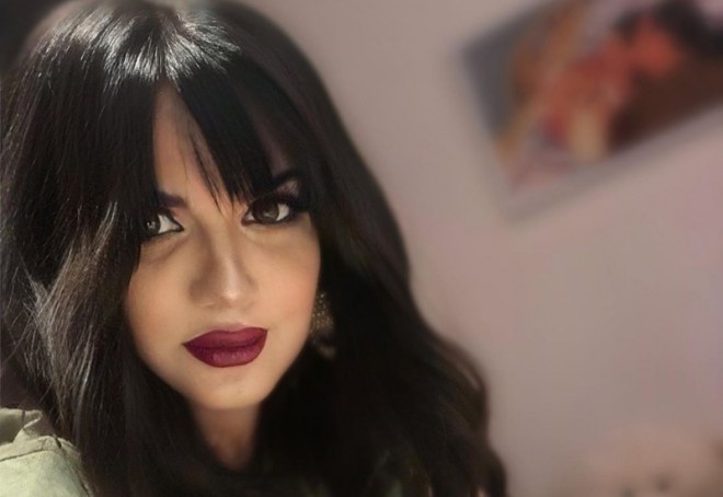 Natavan Həbibi dodaqlarını şişirtdi - foto