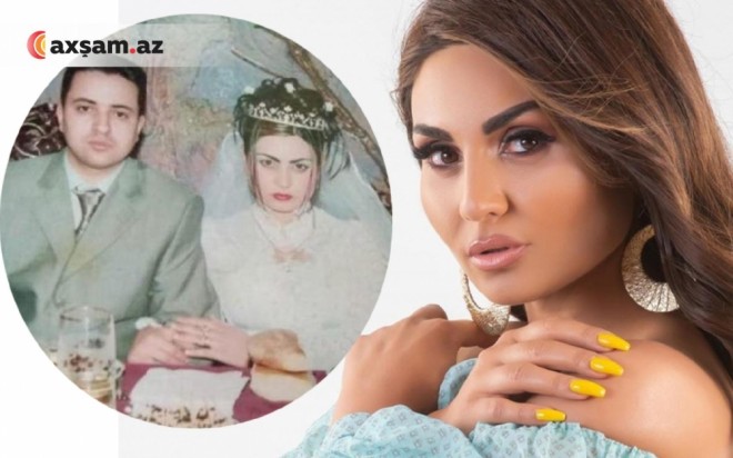 Şəbnəm Tovuzlunun toy fotosu&nbsp;