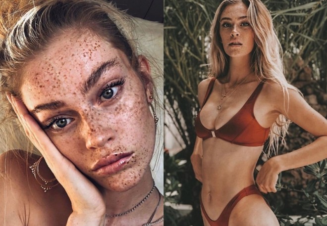 Model çilləri ilə məşhurdur - foto