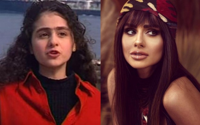 Günelin plastik əməliyyatları gündəm oldu