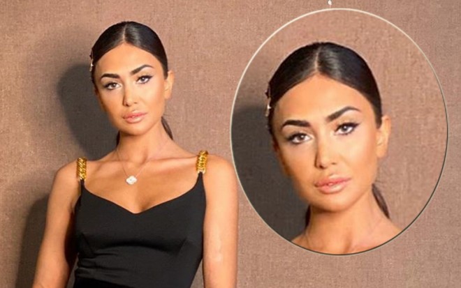 Pərvin Abıyeva dodaqlarını böyütdürdü - foto