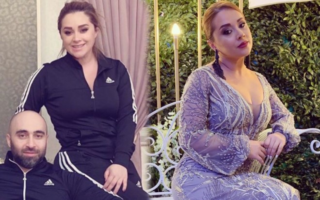 Xatirə kökəlməsinin səbəbini açıqladı