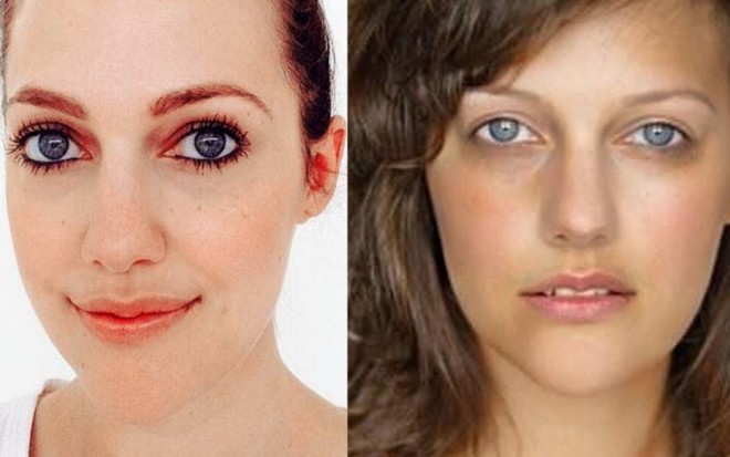 Aktrisa estetik müdaxiləni etiraf etdi