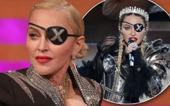 Madonna dünya turunu ləğv etdi
