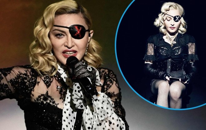 Madonnanın başına iş gəldi