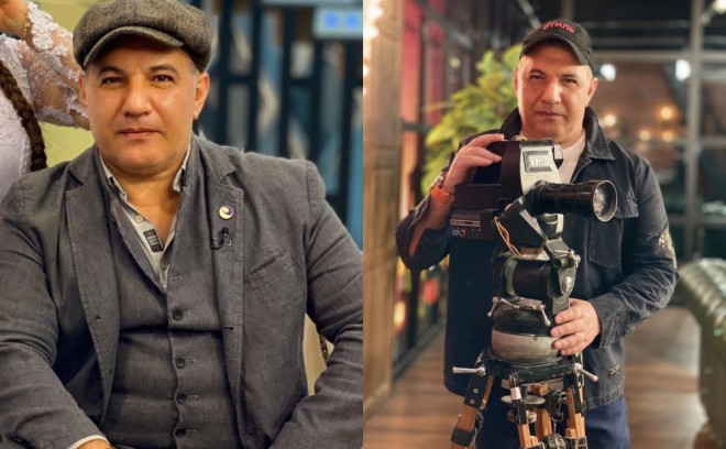 Əməkdar artist saç əkdirdi və gizlətdi