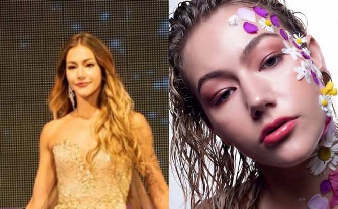 "Miss Universe" gözəli vəfat etdi