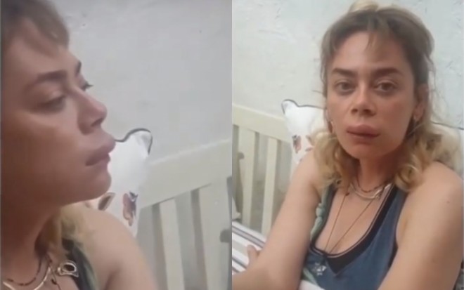 Arı aktrisanı dodağından sancdı - video