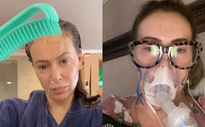 Alissa Milanonun saçları töküldü