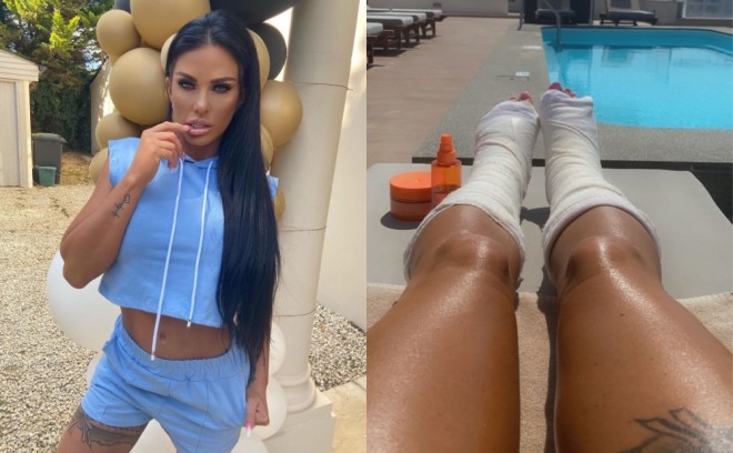 Keti Praysın ayaqları sındı - foto