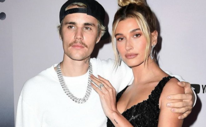 Model həyat yoldaşını qısqanır