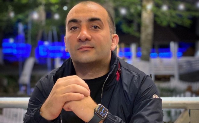 Nicat saç əkdirməyi planlaşdırır