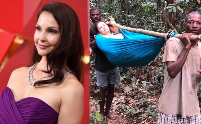 Aktrisanın siniri zədələnib