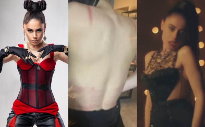 Klipdəki geyim bədənini incidib - foto