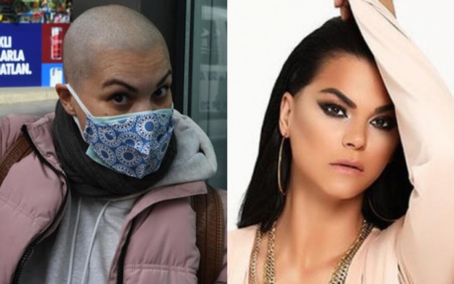 "Qadınlıq təkcə saçla olmur..." 