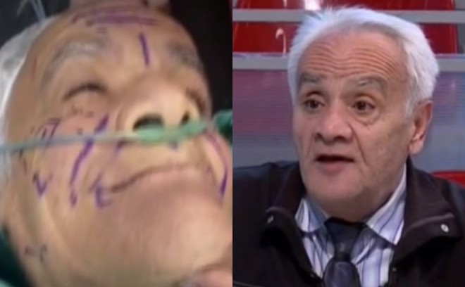 Əməkdar artist plastik əməliyyat etdirib