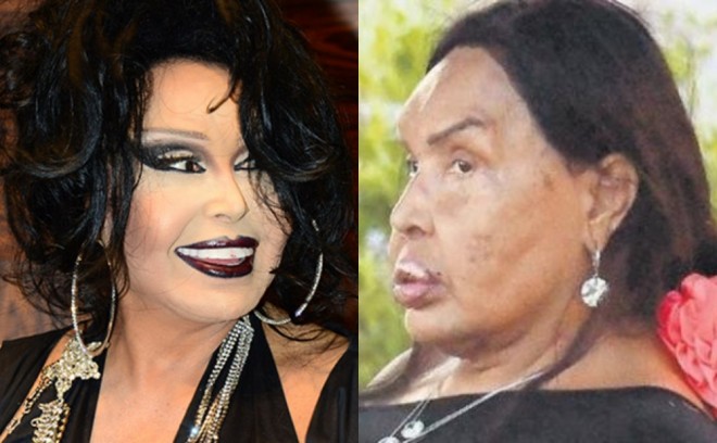 Bülənt Ərsoyun makiyajsız halı diqqət çəkdi - foto