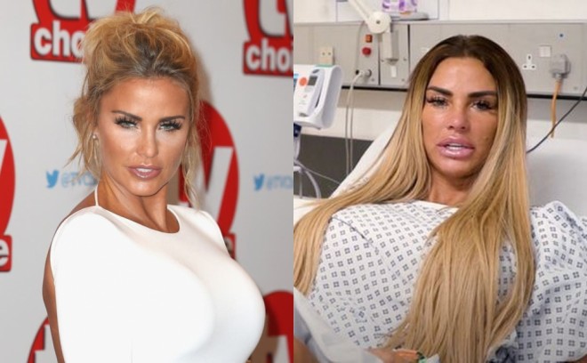 Modeli evinə girib döydülər