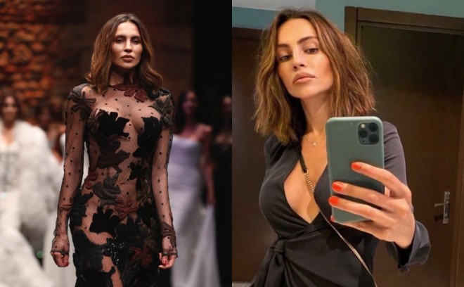 Günay plastik əməliyyat etdirib - foto