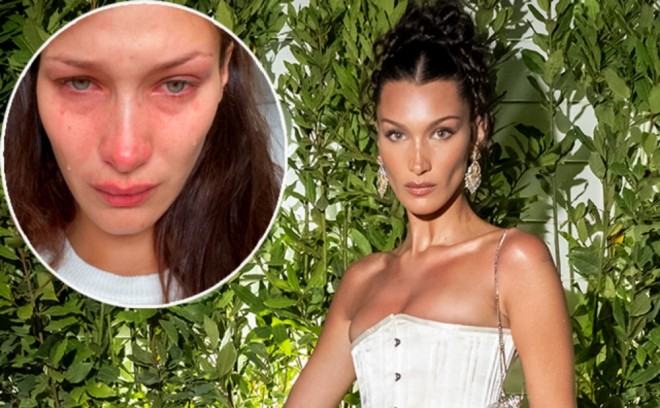 Model göz yaşlarına qərq oldu - foto