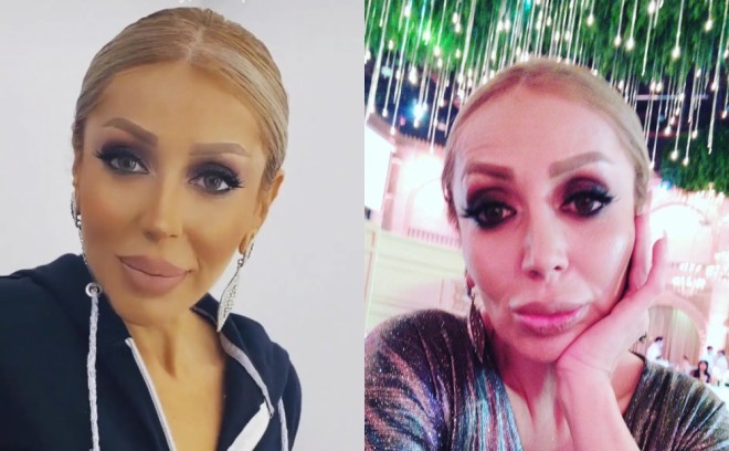 Emma yeni fotosu ilə müzakirə yaratdı