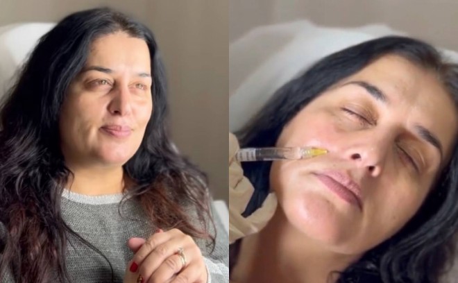 Elza kosmetoloq yanına getmir - foto